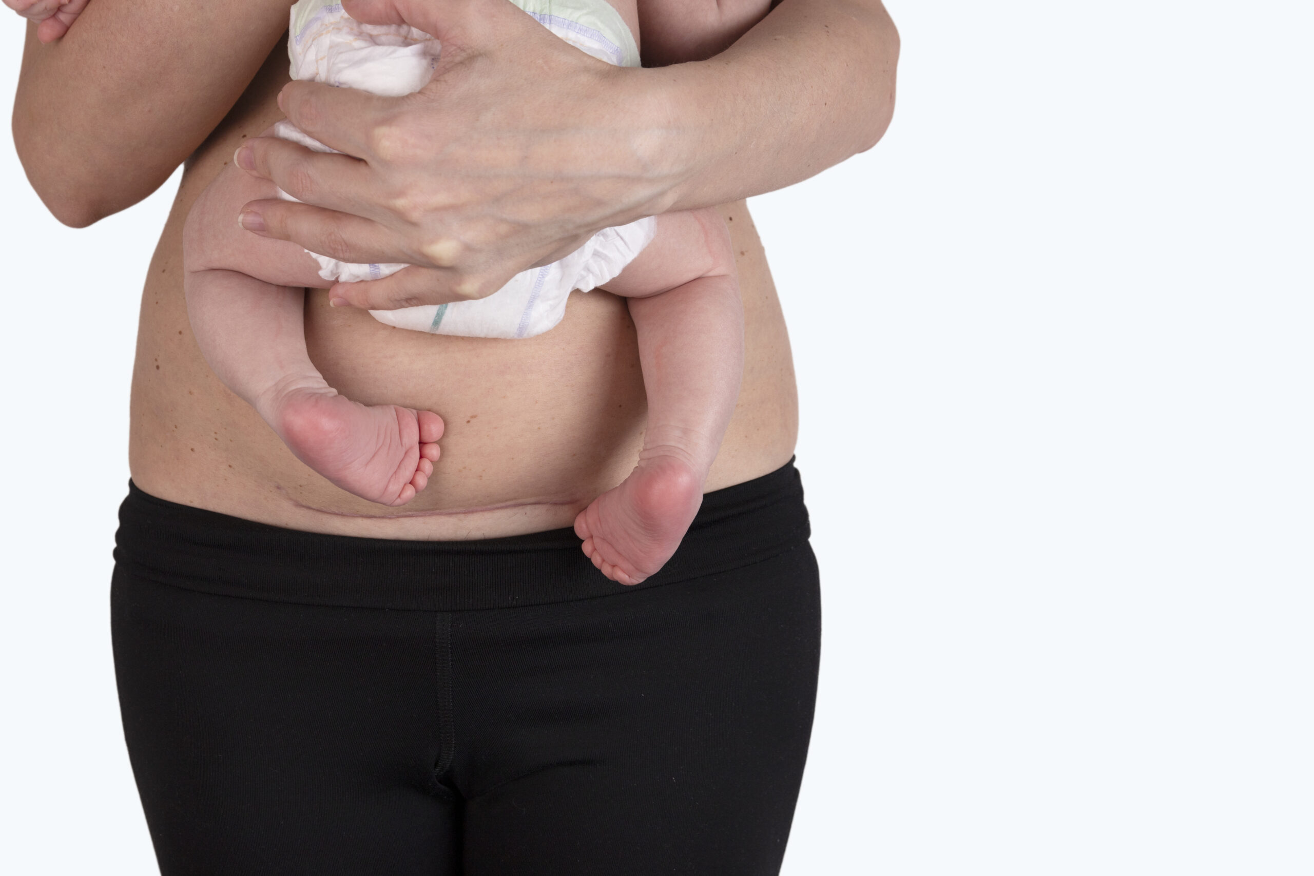 Женщина с животом после родов и ребенком на руках